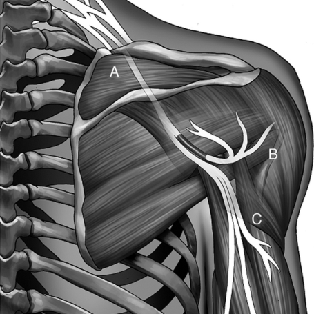 Lesiones nerviosas traumáticas