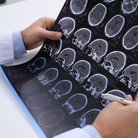 Neurocirugía Adultos