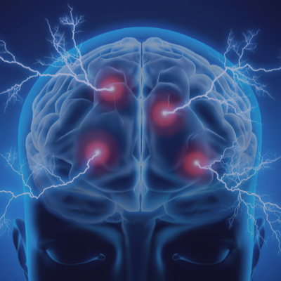 Quistes Cerebrales. Te lo explicamos todo